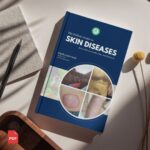 The Holistic Guide to Skin Diseases: Heal with Ayurveda, Yoga, and Lifestyle by Dr. Raghuveer SN